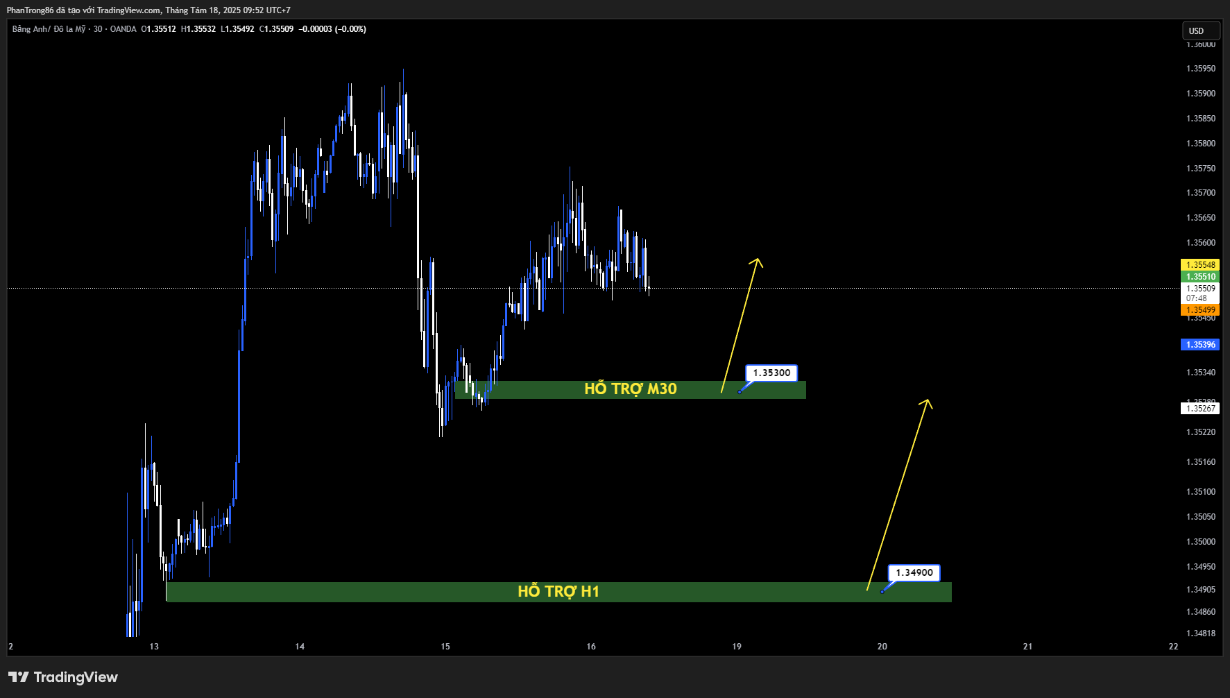 Kế hoạch giao dịch GBP/USD 18/08/2025: Bảng Anh giảm về 1,3550 khi USD hồi phục nhẹ