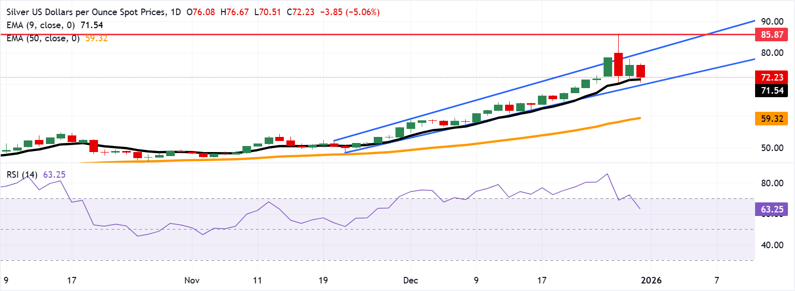 XAG/USD: Biểu đồ hàng ngày