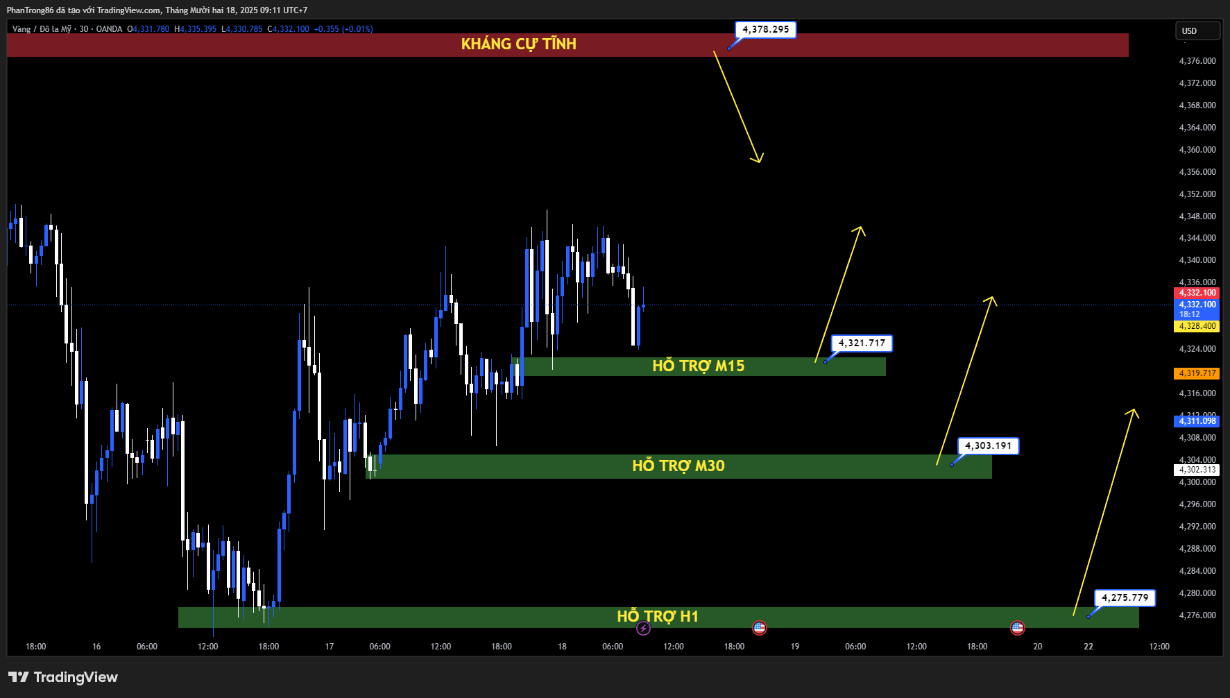 Kế hoạch giao dịch XAU/USD ngày 18/12/2025: Vàng điều chỉnh do chốt lời và USD mạnh lên, thị trường chờ dữ liệu CPI Mỹ