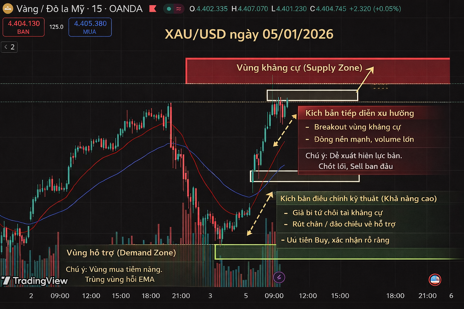 Nhận định & xu hướng giá vàng XAU/USD hôm nay (Thứ 2 – 05/01/2026)