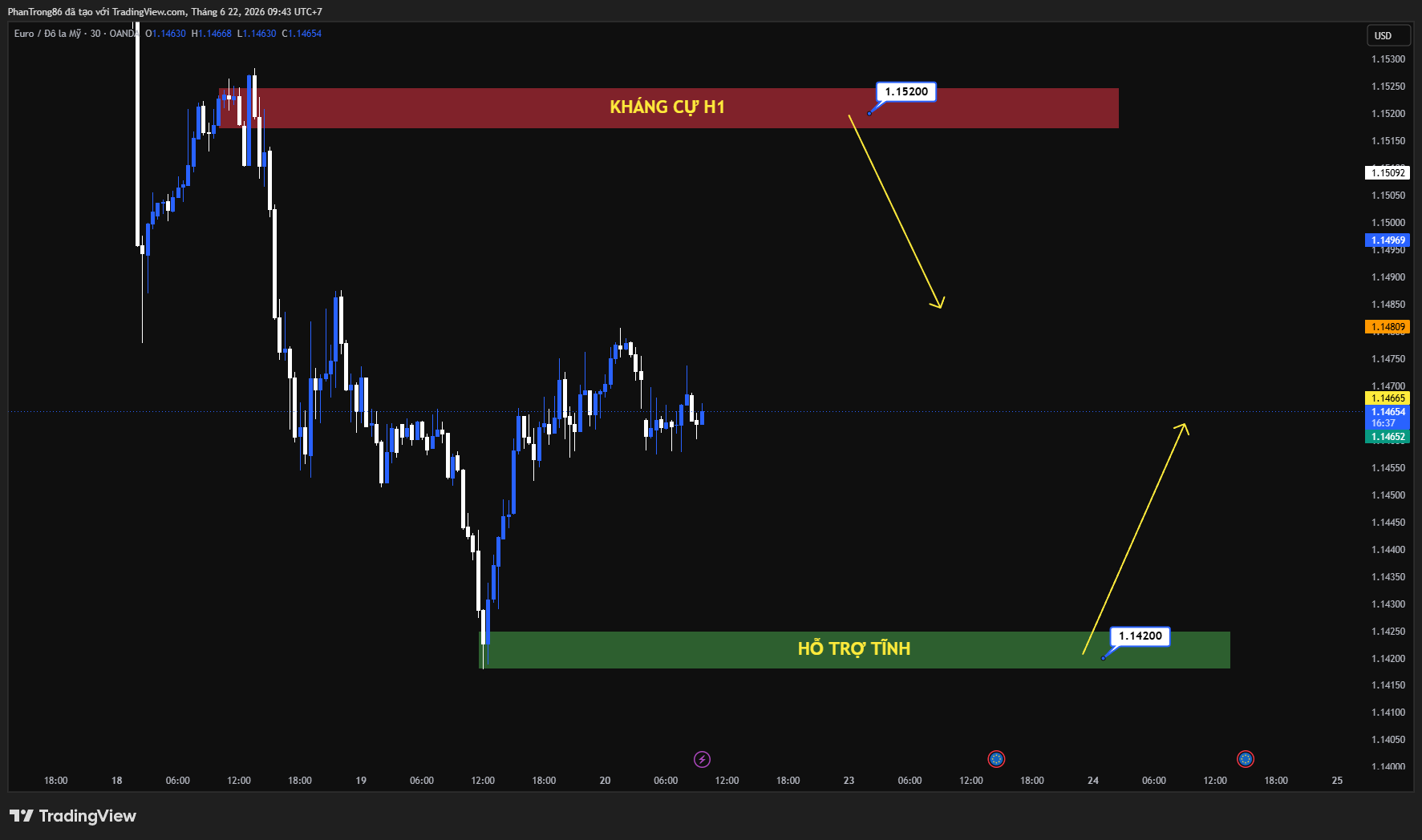 Kế hoạch giao dịch EUR/USD ngày 22/06/2026: Đồng Euro tiếp tục giữ ưu thế hay đối mặt áp lực điều chỉnh?