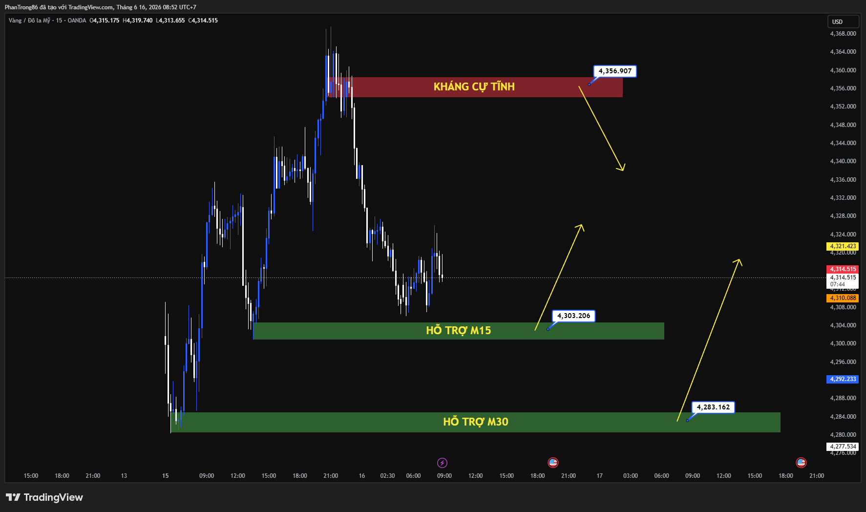 Kế hoạch giao dịch XAU/USD ngày 16/06/2026: Giá vàng tăng nhờ thỏa thuận hòa bình Mỹ-Iran, Fed giảm kỳ vọng tăng lãi suất