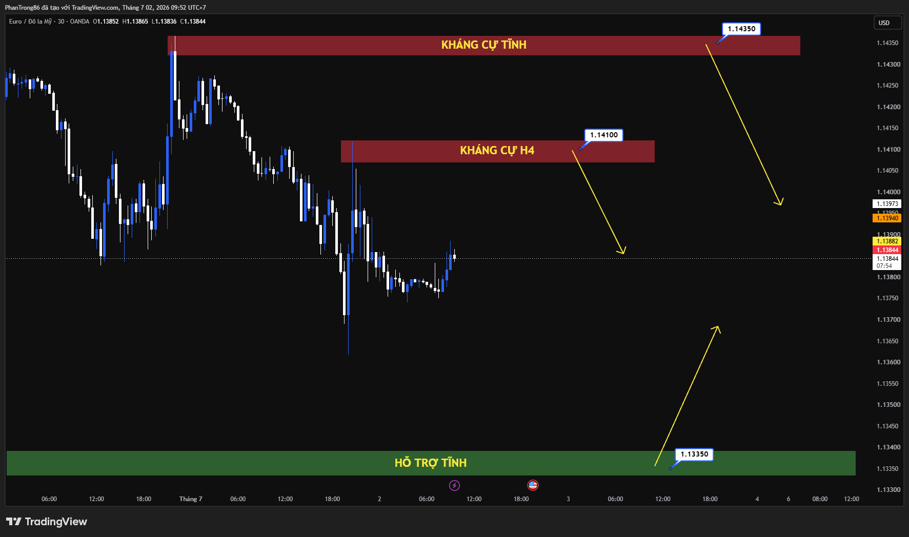 Kế hoạch giao dịch EUR/USD ngày 02/07/2026: EUR/USD chờ tín hiệu quyết định từ báo cáo Nonfarm Payrolls (NFP)